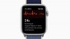 Suivi cardiaque avec l’Apple Watch : un médecin attaque la firme à la pomme